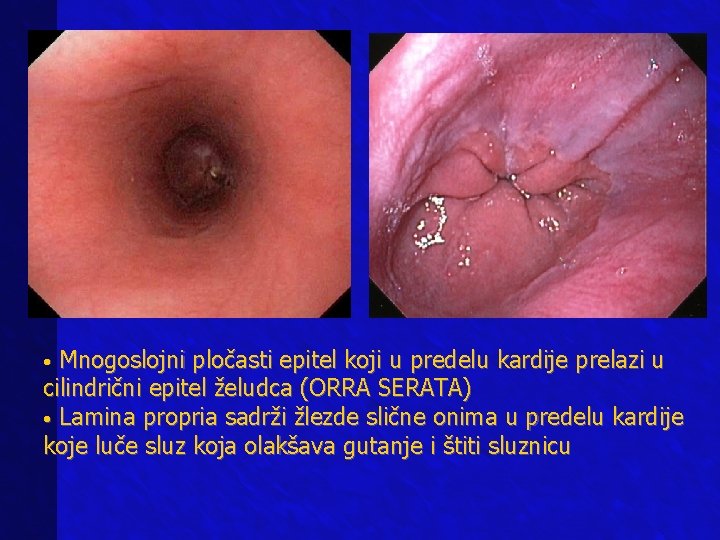 Mnogoslojni pločasti epitel koji u predelu kardije prelazi u cilindrični epitel želudca (ORRA SERATA) Mnogoslojni pločasti epitel koji u predelu kardije prelazi u cilindrični epitel želudca (ORRA SERATA)