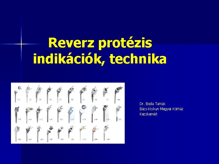 Reverz protézis indikációk, technika Dr. Boda Tamás Bács-Kiskun Megyei Kórház Kecskemét 