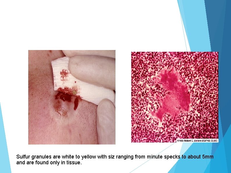 Sulfur granules are white to yellow with siz ranging from minute specks to about