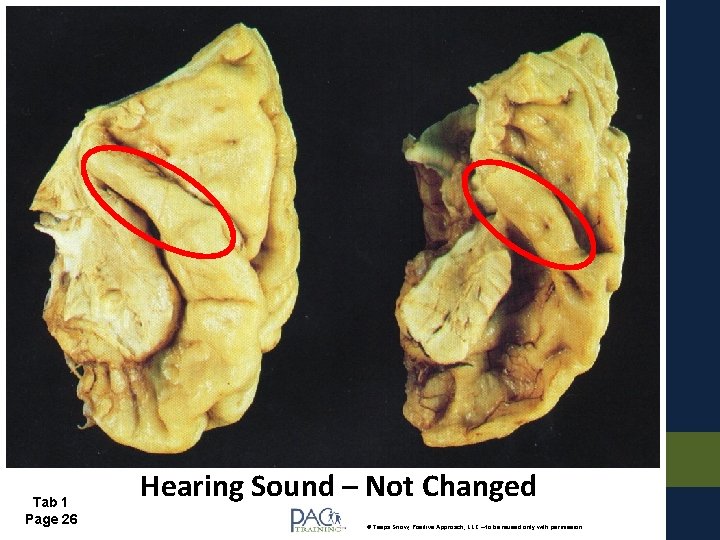 Tab 1 Page 26 Hearing Sound – Not Changed © Teepa Snow, Positive Approach,