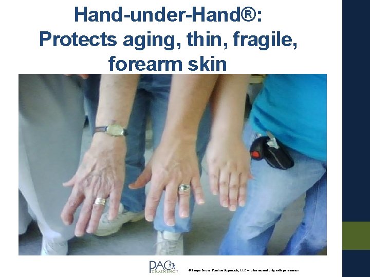 Hand-under-Hand®: Protects aging, thin, fragile, forearm skin © Teepa Snow, Positive Approach, LLC – Hand-under-Hand®: Protects aging, thin, fragile, forearm skin © Teepa Snow, Positive Approach, LLC –