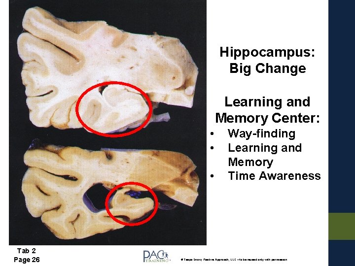 Hippocampus: Big Change Learning and Memory Center: • • • Tab 2 Page 26