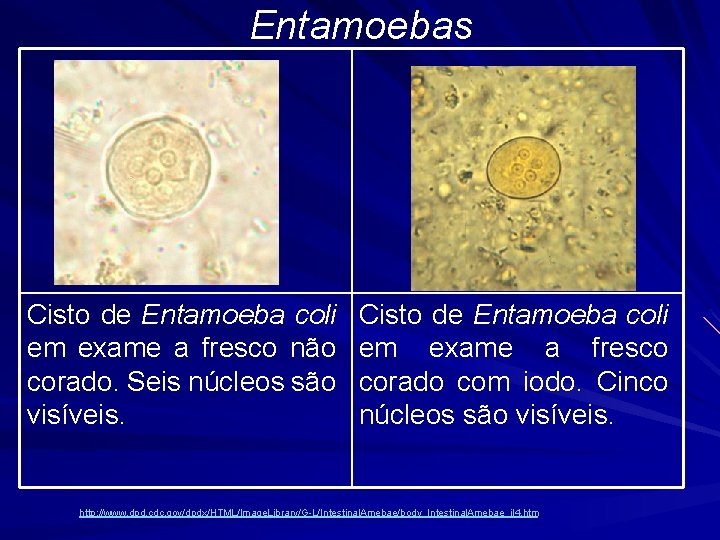 Entamoebas Cisto de Entamoeba coli em exame a fresco não corado. Seis núcleos são