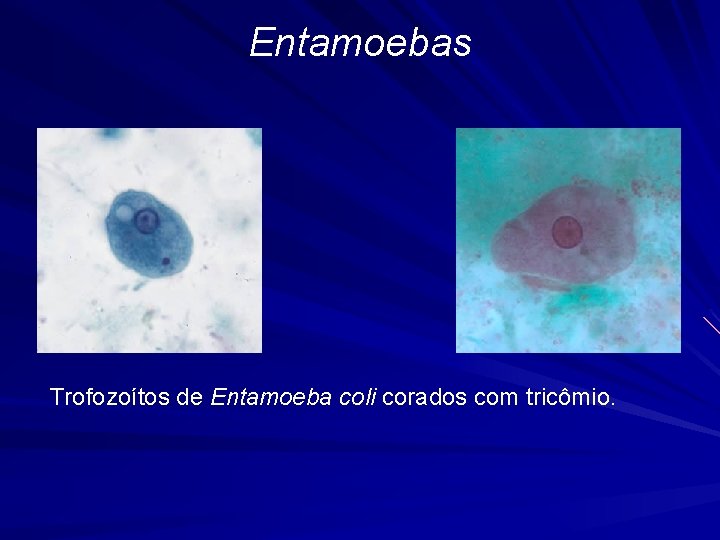 Entamoebas Trofozoítos de Entamoeba coli corados com tricômio. 