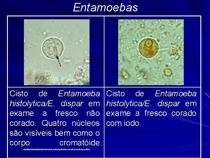 Entamoebas Cisto de Entamoeba histolytica/E. dispar em exame a fresco não corado. Quatro núcleos