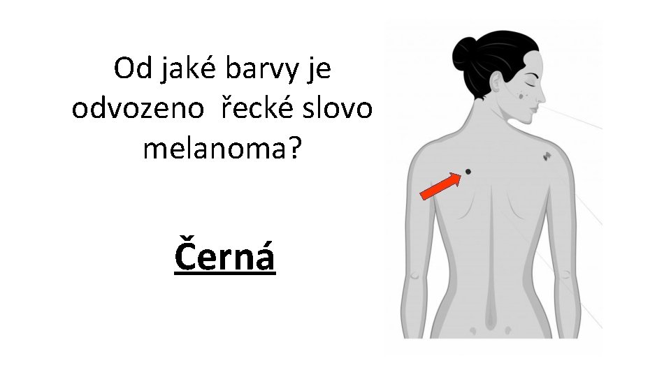 Od jaké barvy je odvozeno řecké slovo melanoma? Černá 