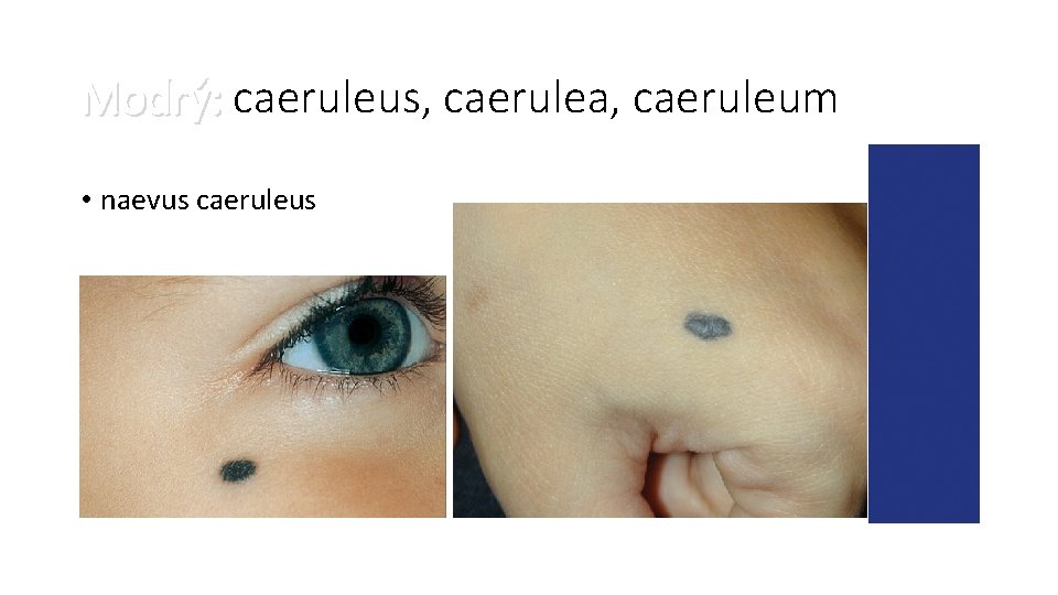 Modrý: caeruleus, caerulea, caeruleum • naevus caeruleus 