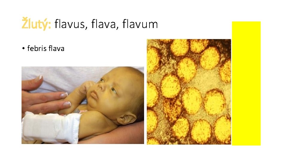 Žlutý: flavus, flava, flavum • febris flava 