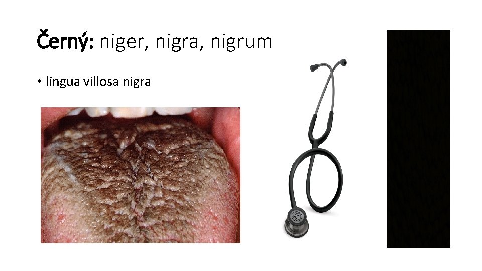 Černý: niger, nigra, nigrum • lingua villosa nigra 