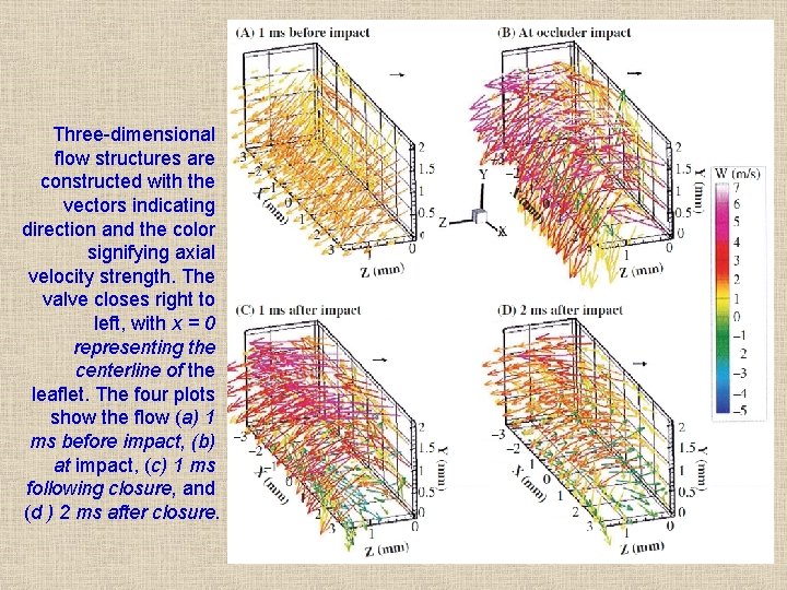 Three-dimensional flow structures are constructed with the vectors indicating direction and the color signifying Three-dimensional flow structures are constructed with the vectors indicating direction and the color signifying