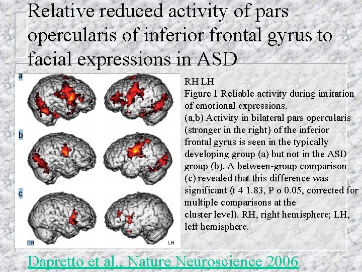 Relative reduced activity of pars opercularis of inferior frontal gyrus to facial expressions in Relative reduced activity of pars opercularis of inferior frontal gyrus to facial expressions in