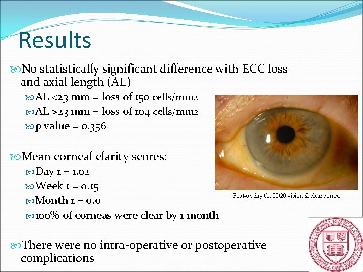 Results No statistically significant difference with ECC loss and axial length (AL) AL <23