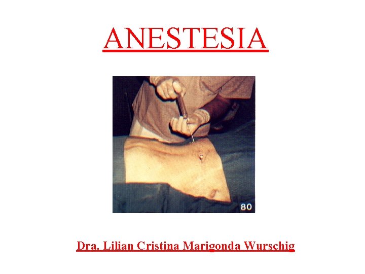 ANESTESIA Dra. Lilian Cristina Marigonda Wurschig 