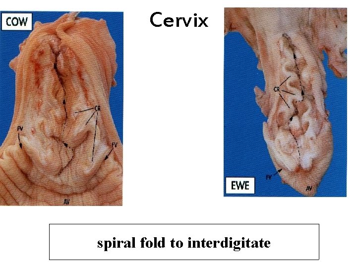 Cervix spiral fold to interdigitate 