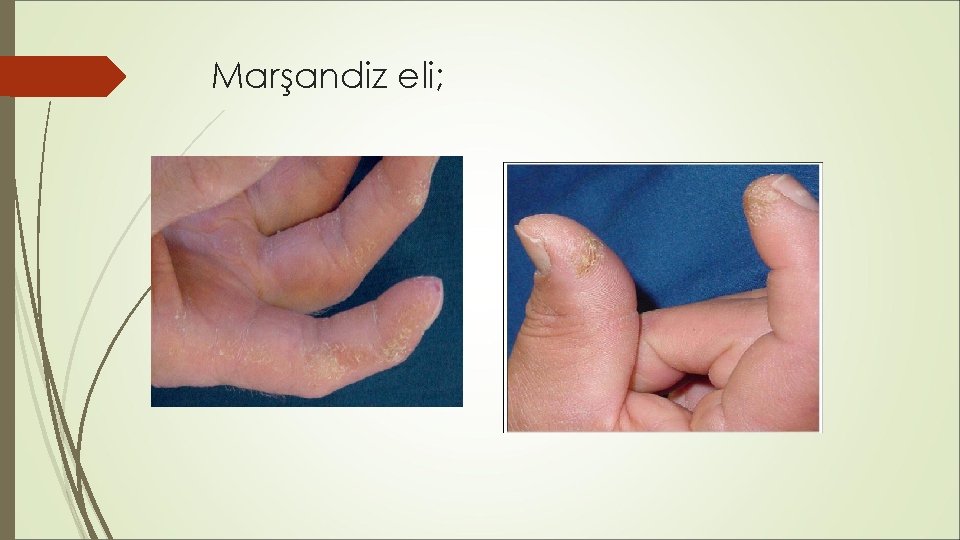 Marşandiz eli; Marşandiz eli;
