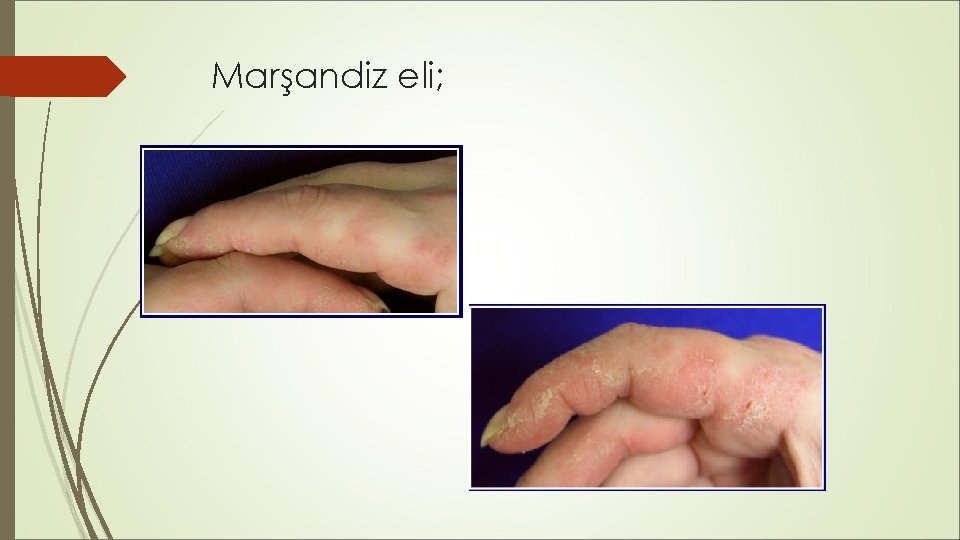 Marşandiz eli; Marşandiz eli;