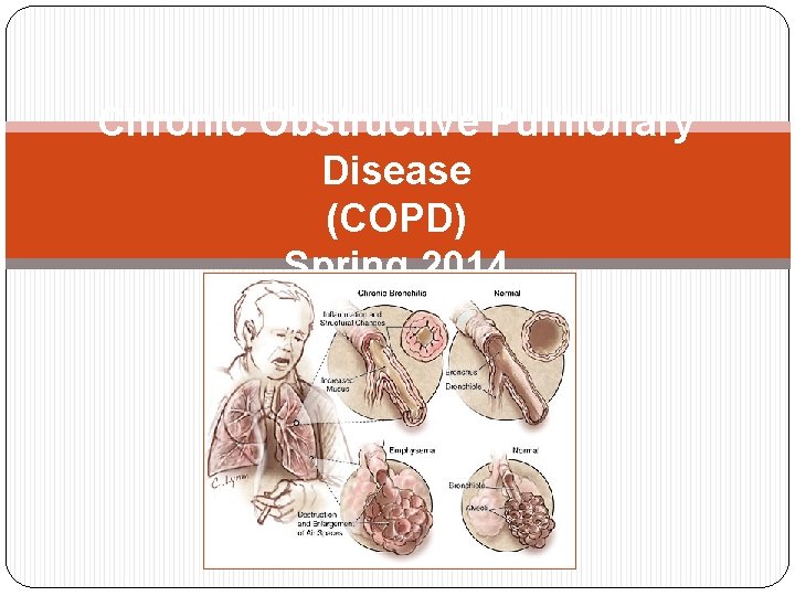 Chronic Obstructive Pulmonary Disease (COPD) Spring 2014 