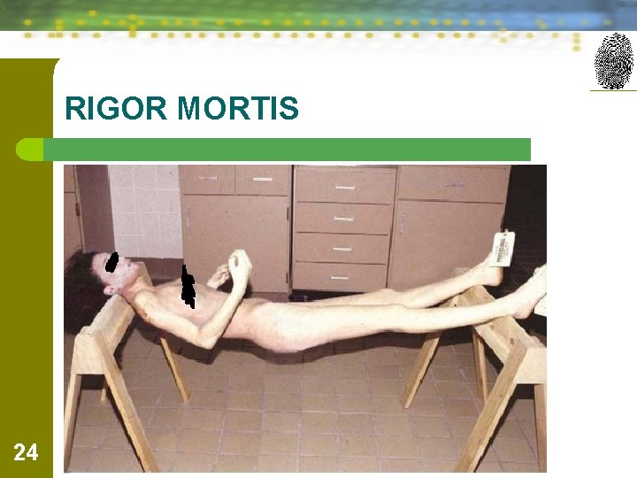 RIGOR MORTIS 24 Forensic Science: Fundamentals & Investigations, Chapter 11 