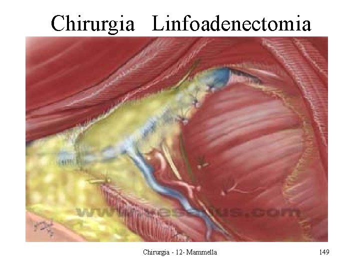 Chirurgia Linfoadenectomia Chirurgia - 12 - Mammella 149 