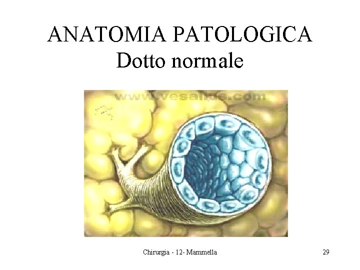 ANATOMIA PATOLOGICA Dotto normale Chirurgia - 12 - Mammella 29 