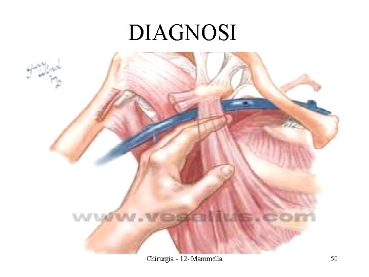 DIAGNOSI Chirurgia - 12 - Mammella 50 