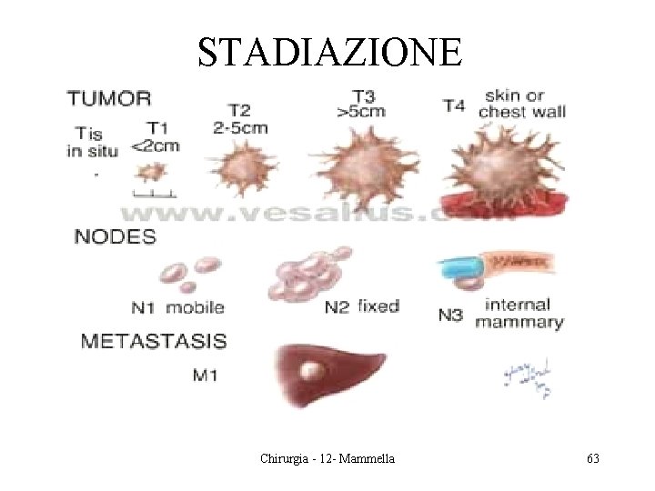 STADIAZIONE Chirurgia - 12 - Mammella 63 