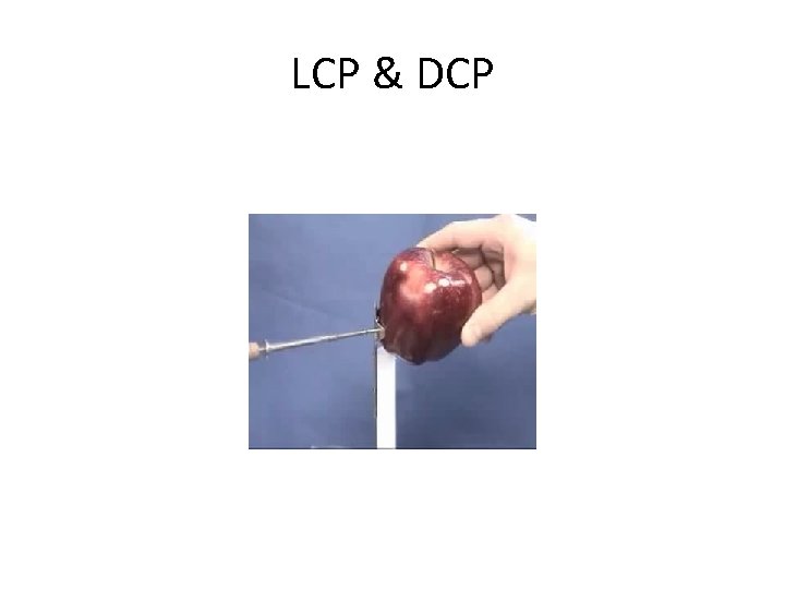 LCP & DCP 