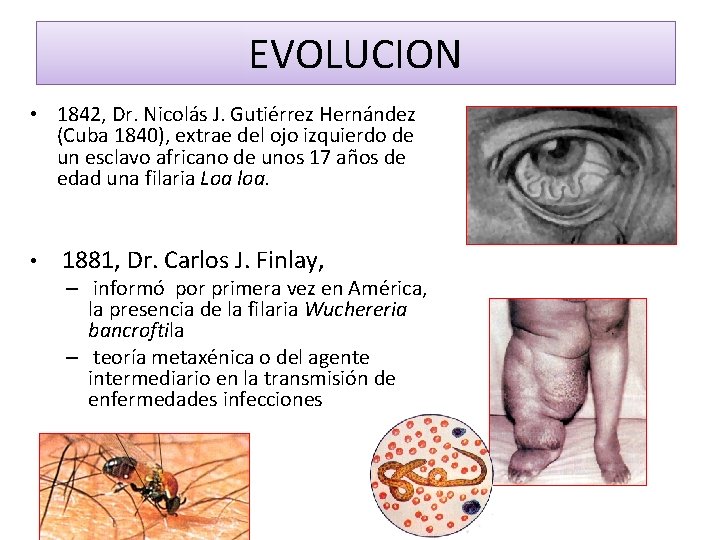 EVOLUCION • 1842, Dr. Nicolás J. Gutiérrez Hernández (Cuba 1840), extrae del ojo izquierdo