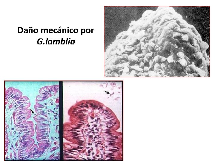 Daño mecánico por G. lamblia 