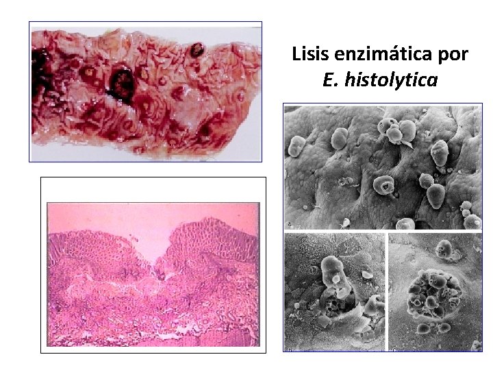 Lisis enzimática por E. histolytica 