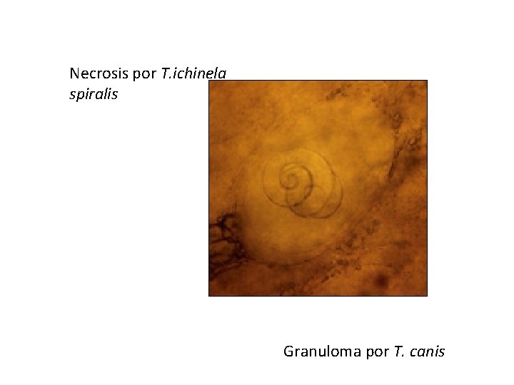 Necrosis por T. ichinela spiralis Granuloma por T. canis 