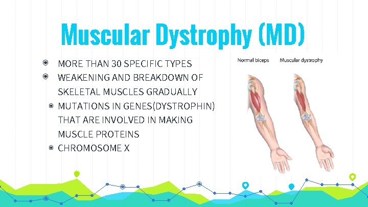 Muscular Dystrophy (MD) ◉ MORE THAN 30 SPECIFIC TYPES ◉ WEAKENING AND BREAKDOWN OF