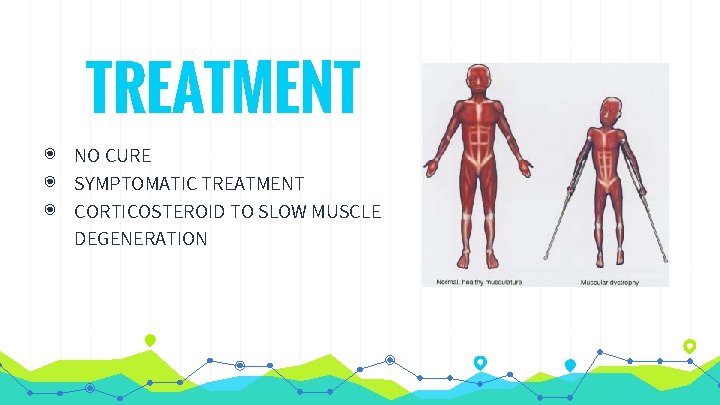 TREATMENT ◉ NO CURE ◉ SYMPTOMATIC TREATMENT ◉ CORTICOSTEROID TO SLOW MUSCLE DEGENERATION 