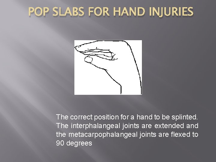 POP SLABS FOR HAND INJURIES The correct position for a hand to be splinted.