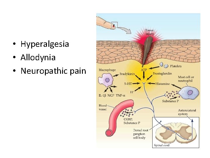  • Hyperalgesia • Allodynia • Neuropathic pain 