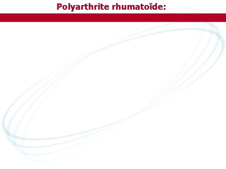 Polyarthrite rhumatoïde: 