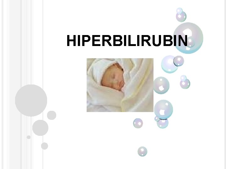 HIPERBILIRUBIN 