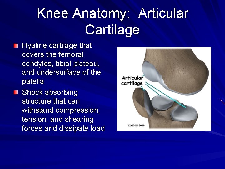 Knee Anatomy: Articular Cartilage Hyaline cartilage that covers the femoral condyles, tibial plateau, and