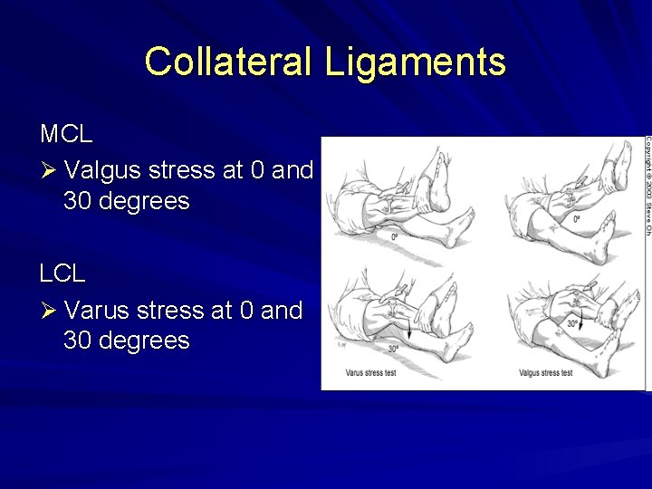 Collateral Ligaments MCL Ø Valgus stress at 0 and 30 degrees LCL Ø Varus