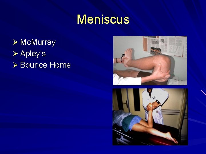 Meniscus Ø Mc. Murray Ø Apley’s Ø Bounce Home 