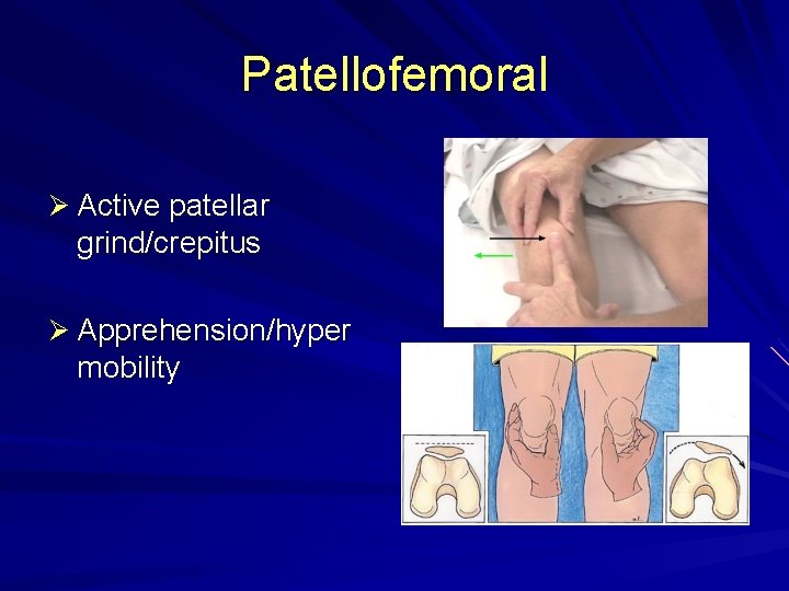 Patellofemoral Ø Active patellar grind/crepitus Ø Apprehension/hyper mobility 