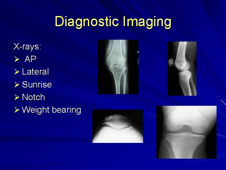 Diagnostic Imaging X-rays: Ø AP Ø Lateral Ø Sunrise Ø Notch Ø Weight bearing