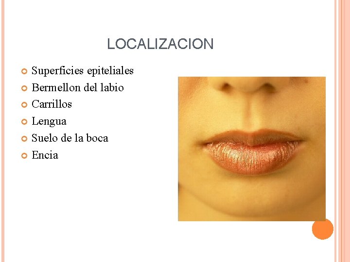 LOCALIZACION Superficies epiteliales Bermellon del labio Carrillos Lengua Suelo de la boca Encia 