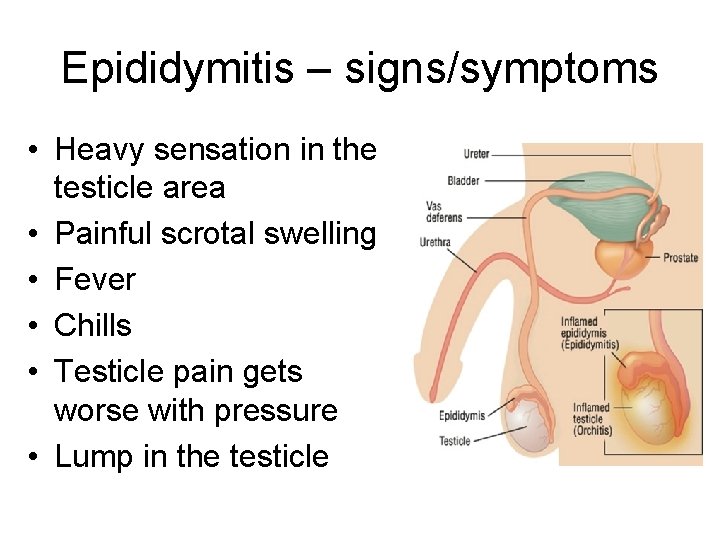 Epididymitis – signs/symptoms • Heavy sensation in the testicle area • Painful scrotal swelling