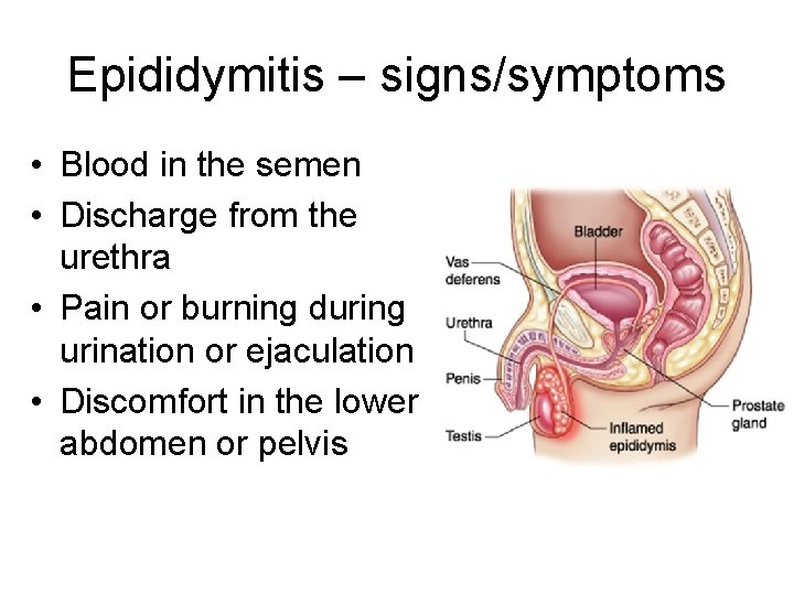 Epididymitis – signs/symptoms • Blood in the semen • Discharge from the urethra •