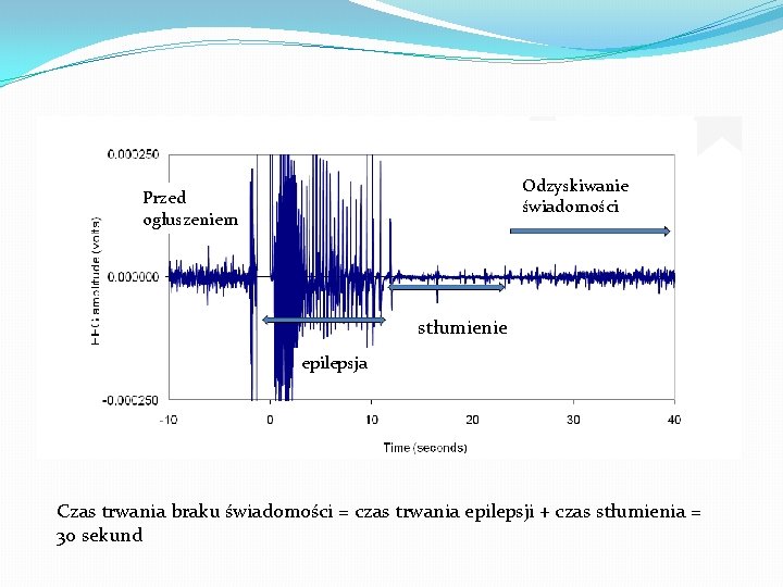 Obraz EEG Odzyskiwanie świadomości Przed ogłuszeniem stłumienie epilepsja Czas trwania braku świadomości = czas