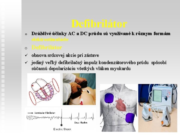 Defibrilátor o Dráždivé účinky AC a DC prúdu sú využívané k rôznym formám elektrostimulácie