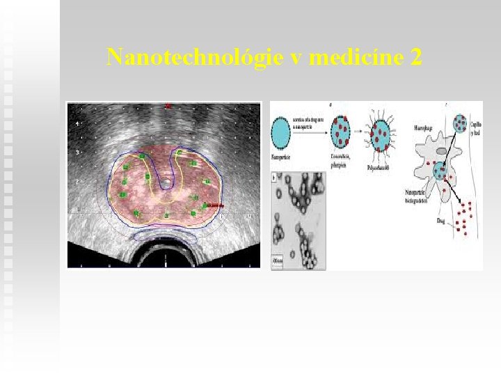 Nanotechnológie v medicíne 2 