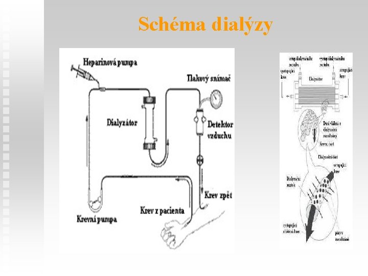 Schéma dialýzy 