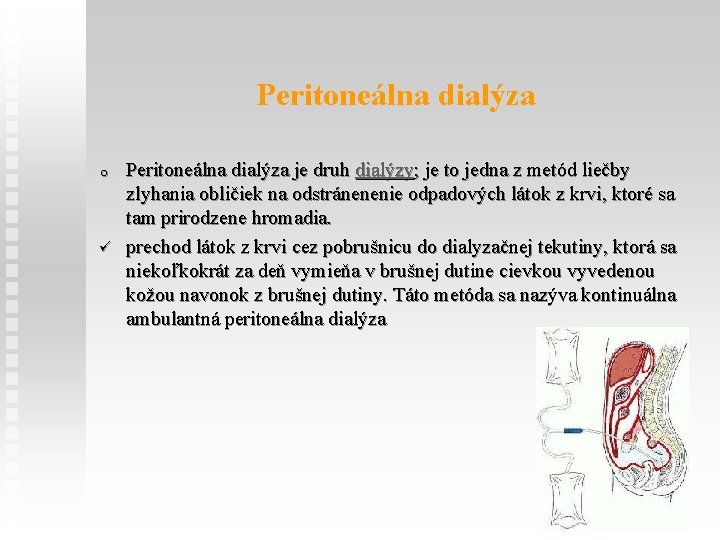 Peritoneálna dialýza o ü Peritoneálna dialýza je druh dialýzy; je to jedna z metód